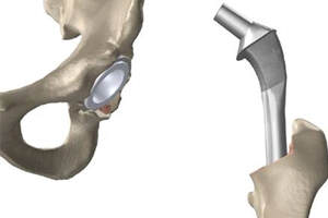 Complex Medical Parts Scanning